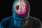 سن سکته مغزی پایین آمده است / سالانه ۱۲ هزار نفر مبتلا